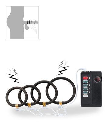 Estim cock ring kit